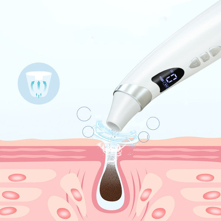 Electric Visual Blackhead Remover – 20x Magnification, 4 Heads, App-Connected Pore Cleaner